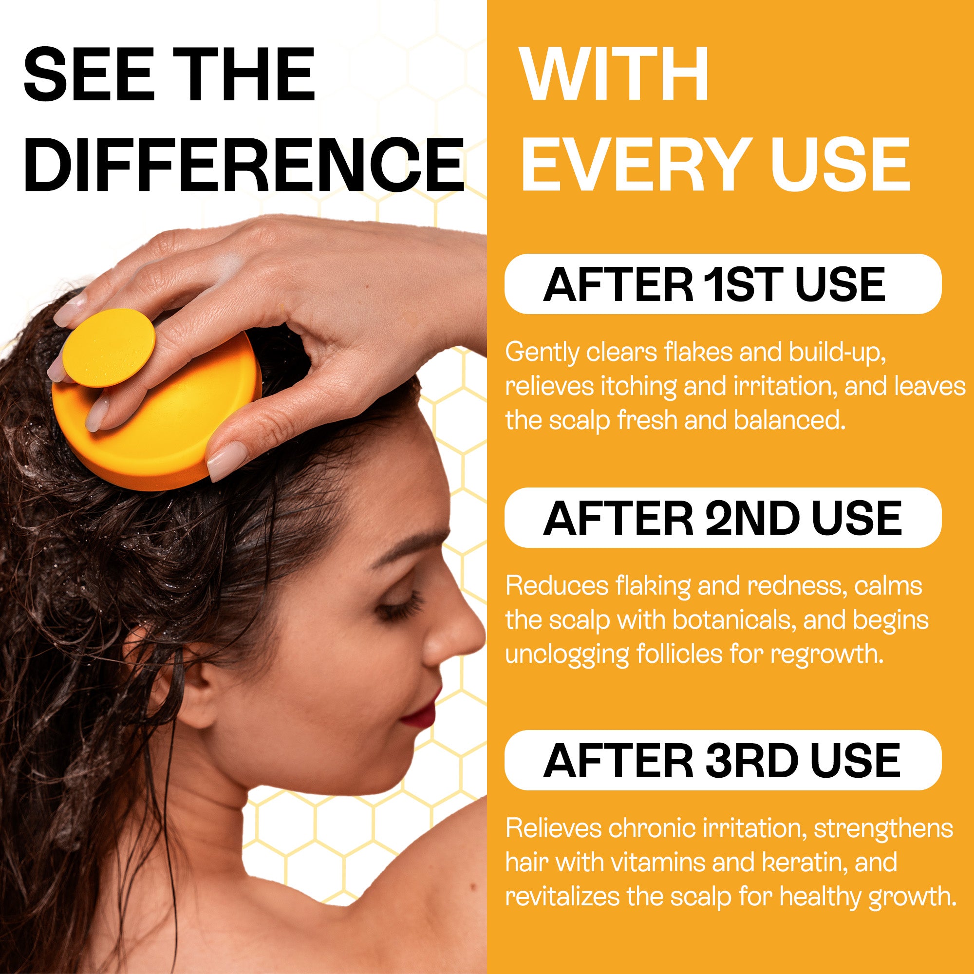 Psoriasis Shampoo for Dry, Itchy & Flaky Scalp | Eczema, Folliculitis & Seborrheic Dermatitis Care | Manuka Honey – 200ml