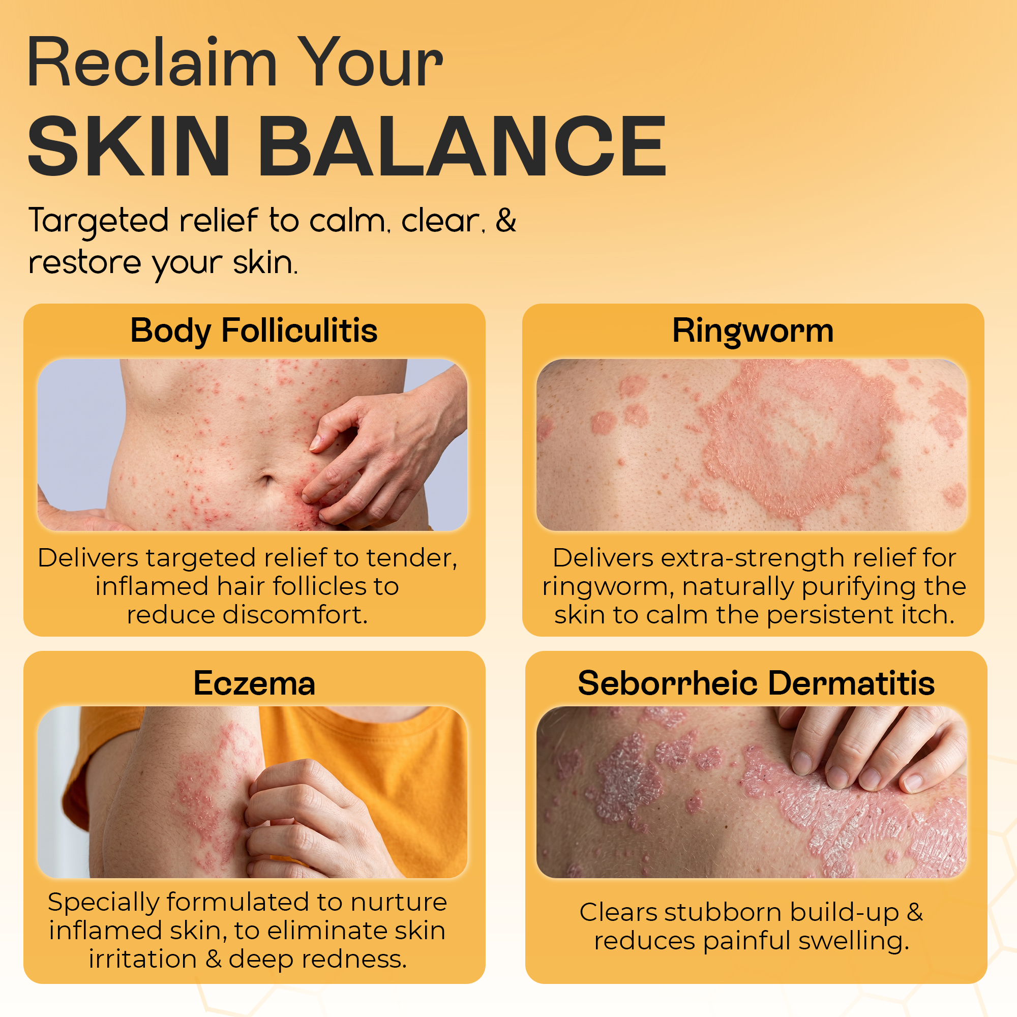 Psoriasis Body Wash | Itch, Redness & Flake Relief