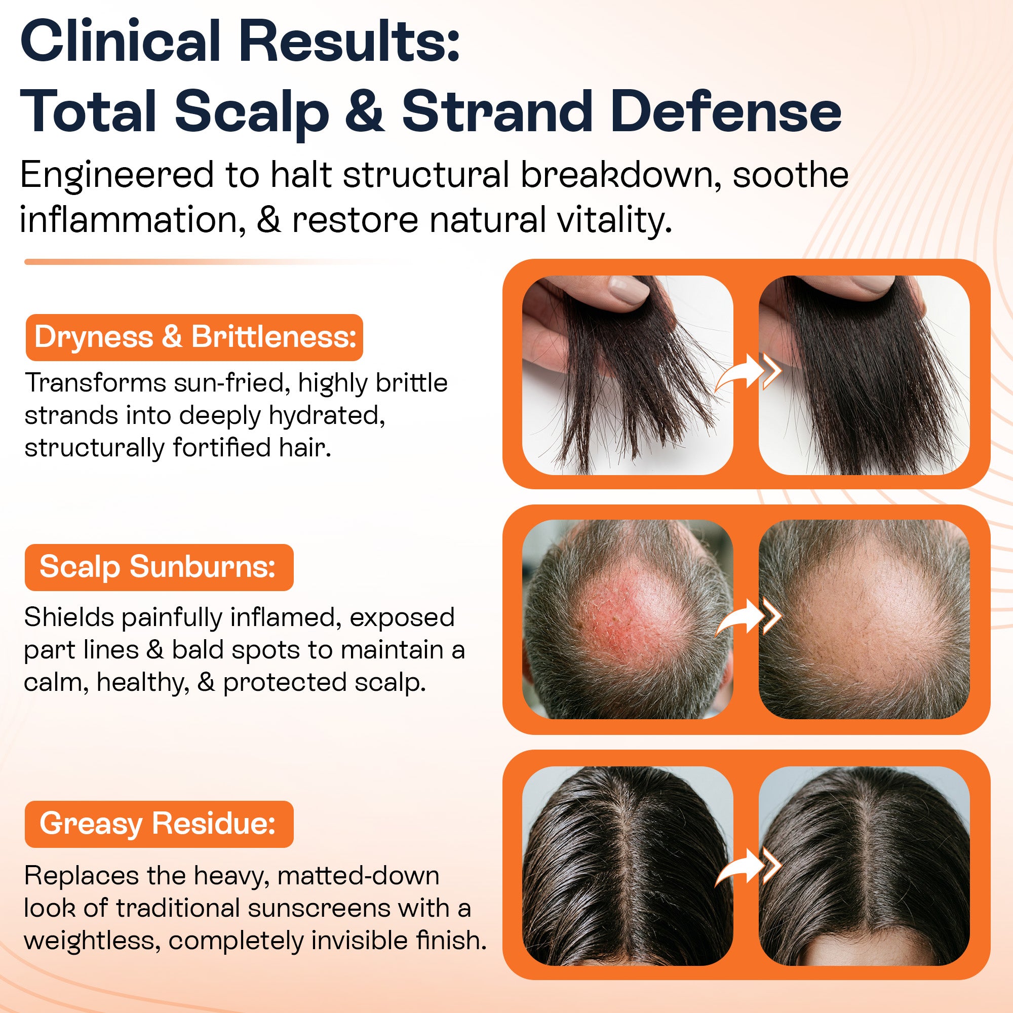 Scalp Sunscreen Spray SPF 30 | UV & Heat Protection for Hair & Scalp