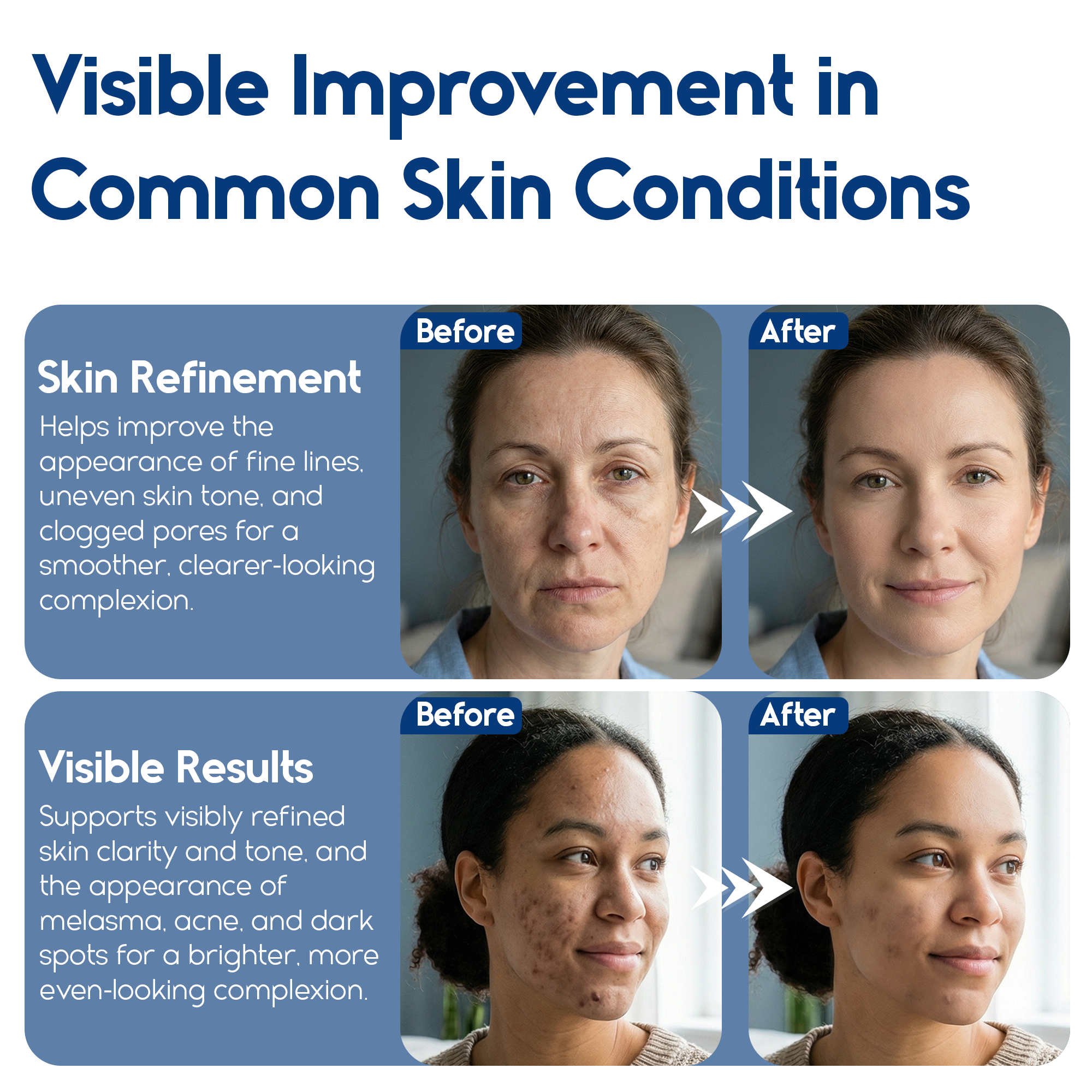 Glycolic Acid Pads 35% for Dark Spots – Exfoliation, Brightening & Skin Renewal