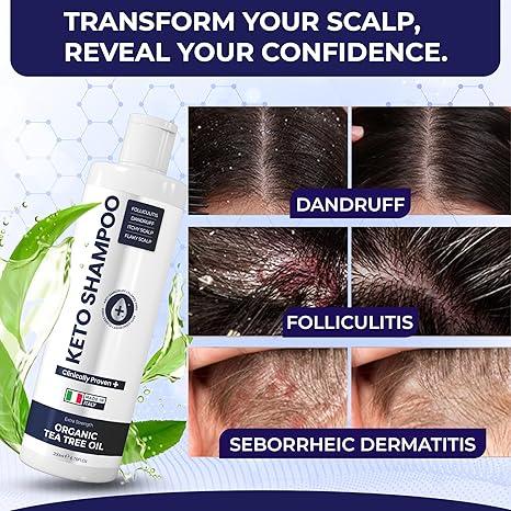 Advanced Sulfate - Free Tea Tree Shampoo | Refreshing Scalp Care & Hair Support - Pharmlitalia