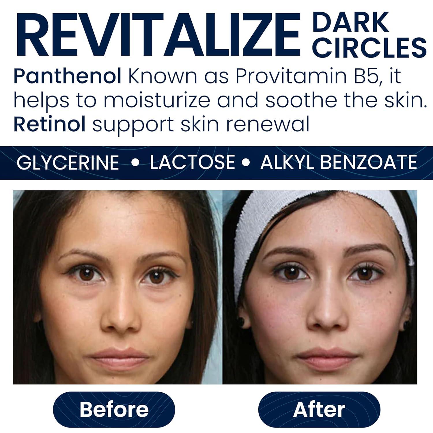 Anti Wrinkle Retinol Eye Cream for Puffiness & Bags Under Eyes - Pharmlitalia