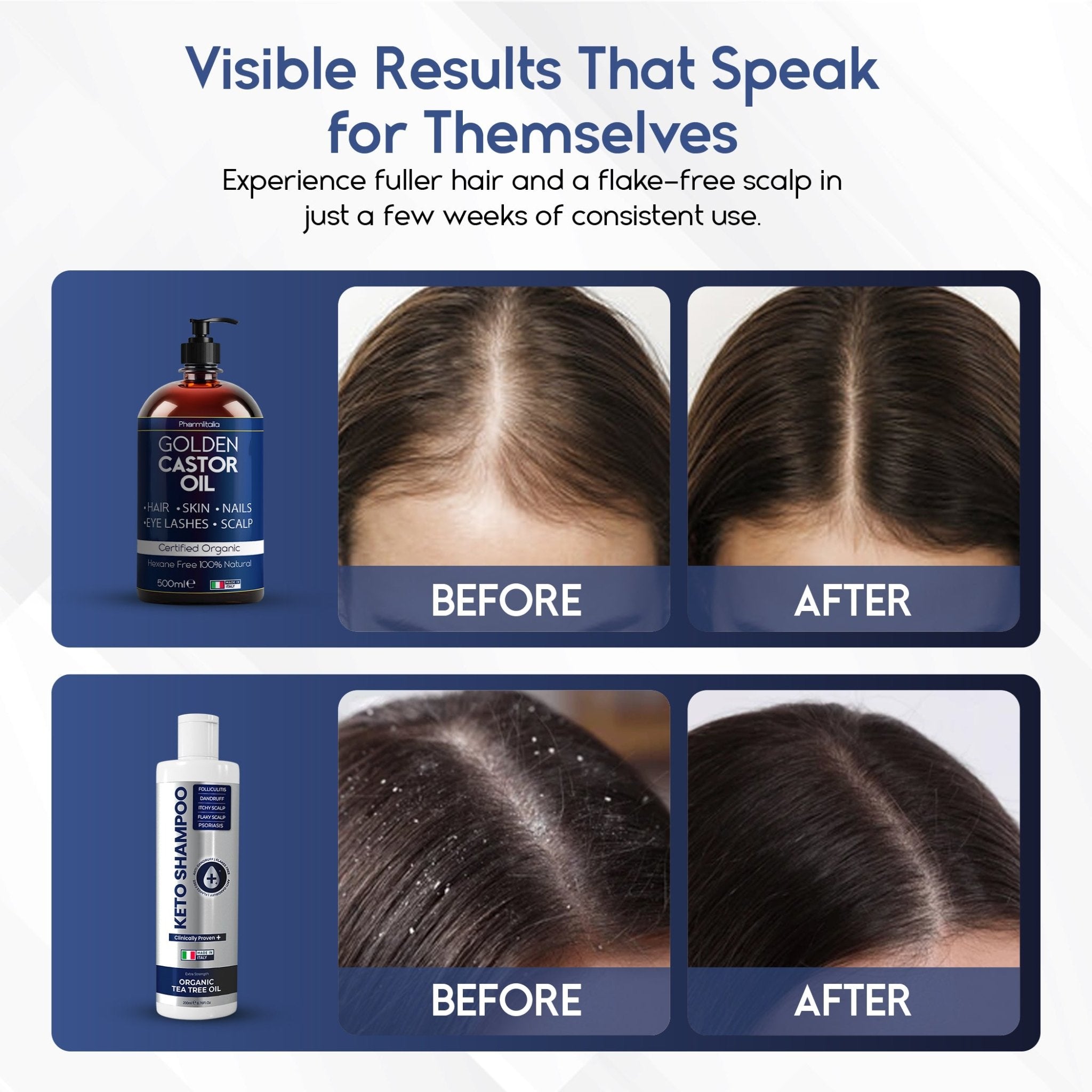 Hair Care Bundle - Pharmlitalia