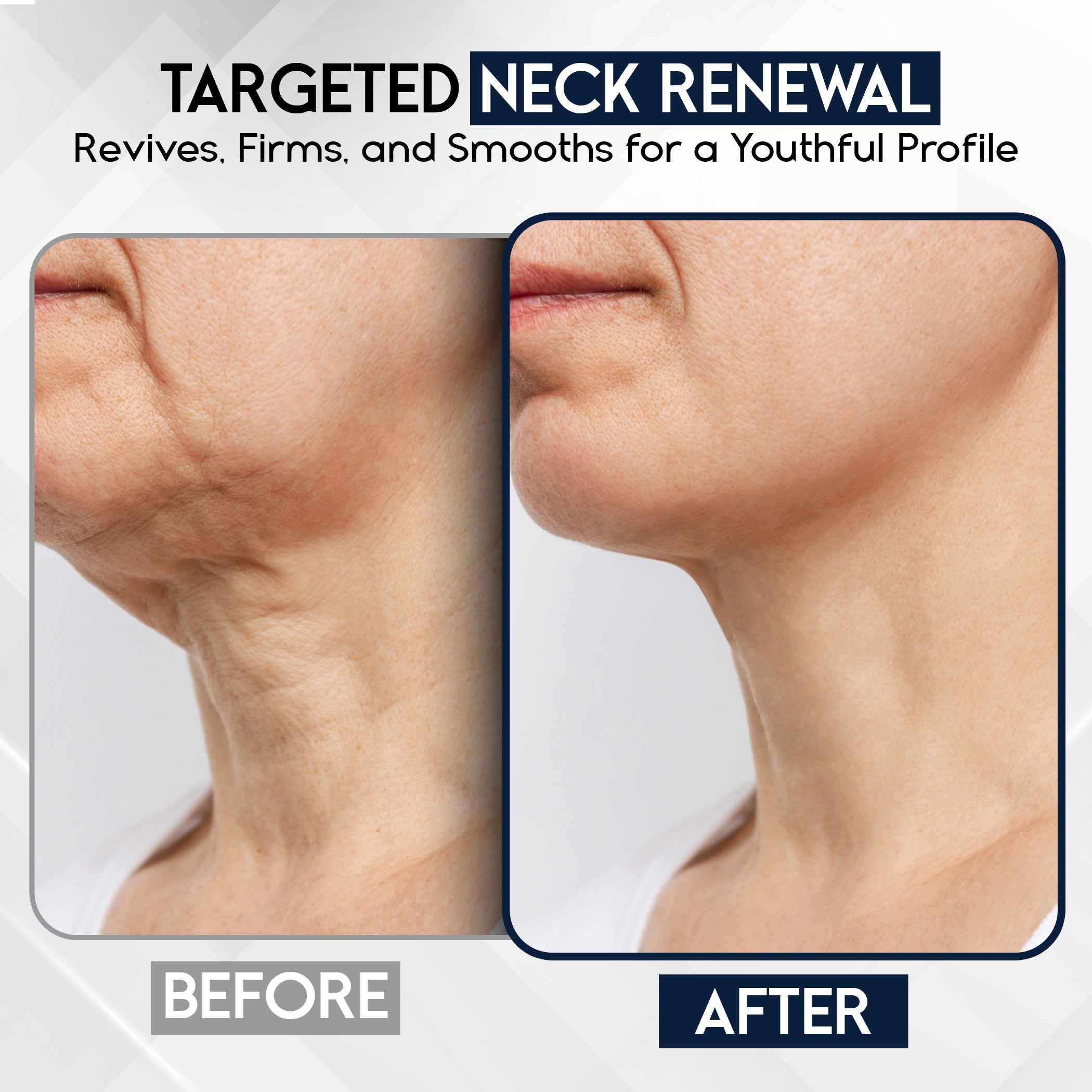 Neck Firming & Tightening Cream