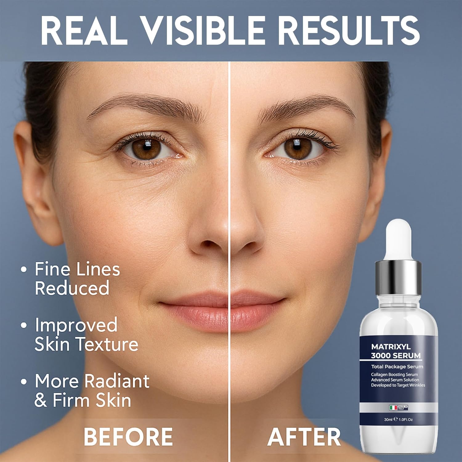 Matrixyl® 3000 Collagen Serum - Pharmlitalia