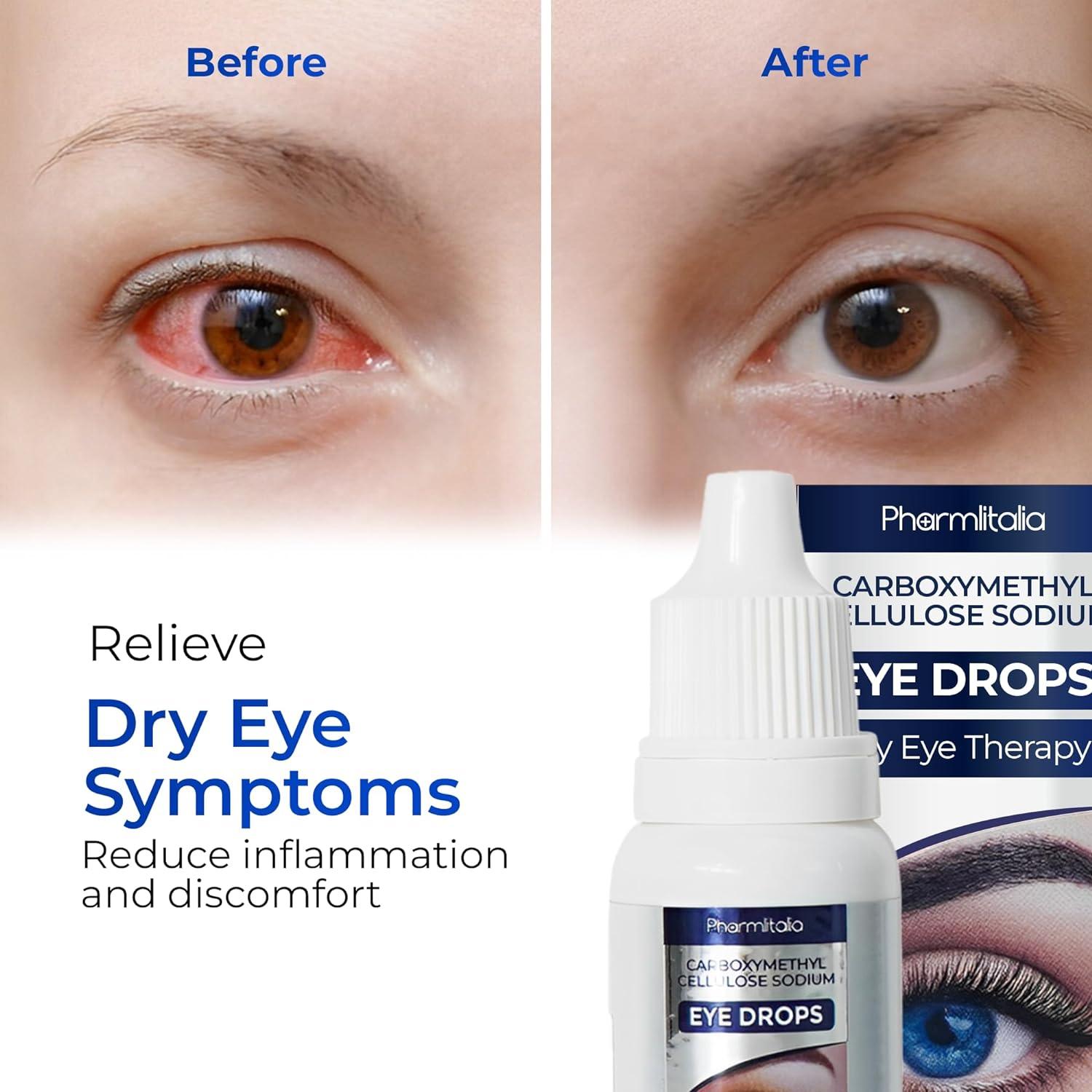 Preservative - Free Eye Drops - Moisturizing Therapy for Dry, Sensitive, and Irritated Eyes - Gentle Redness Relief & Hydration - Pharmlitalia