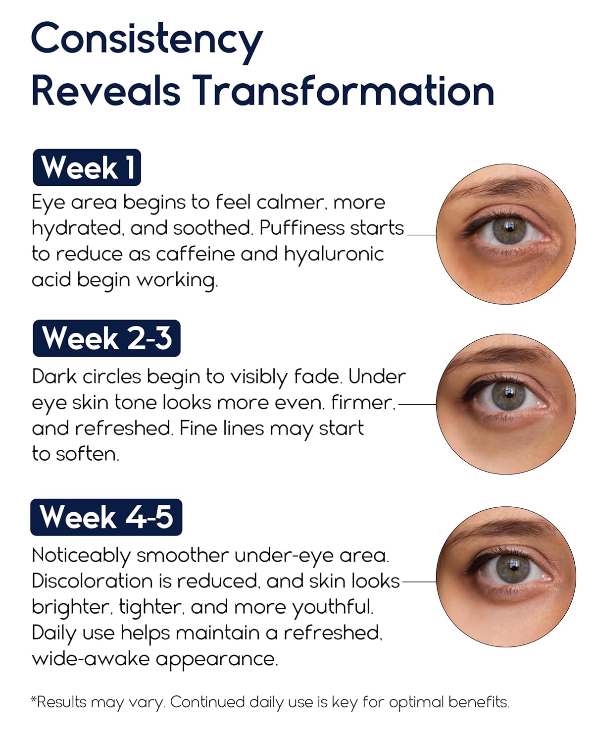Retinol Eye Cream - Pharmlitalia