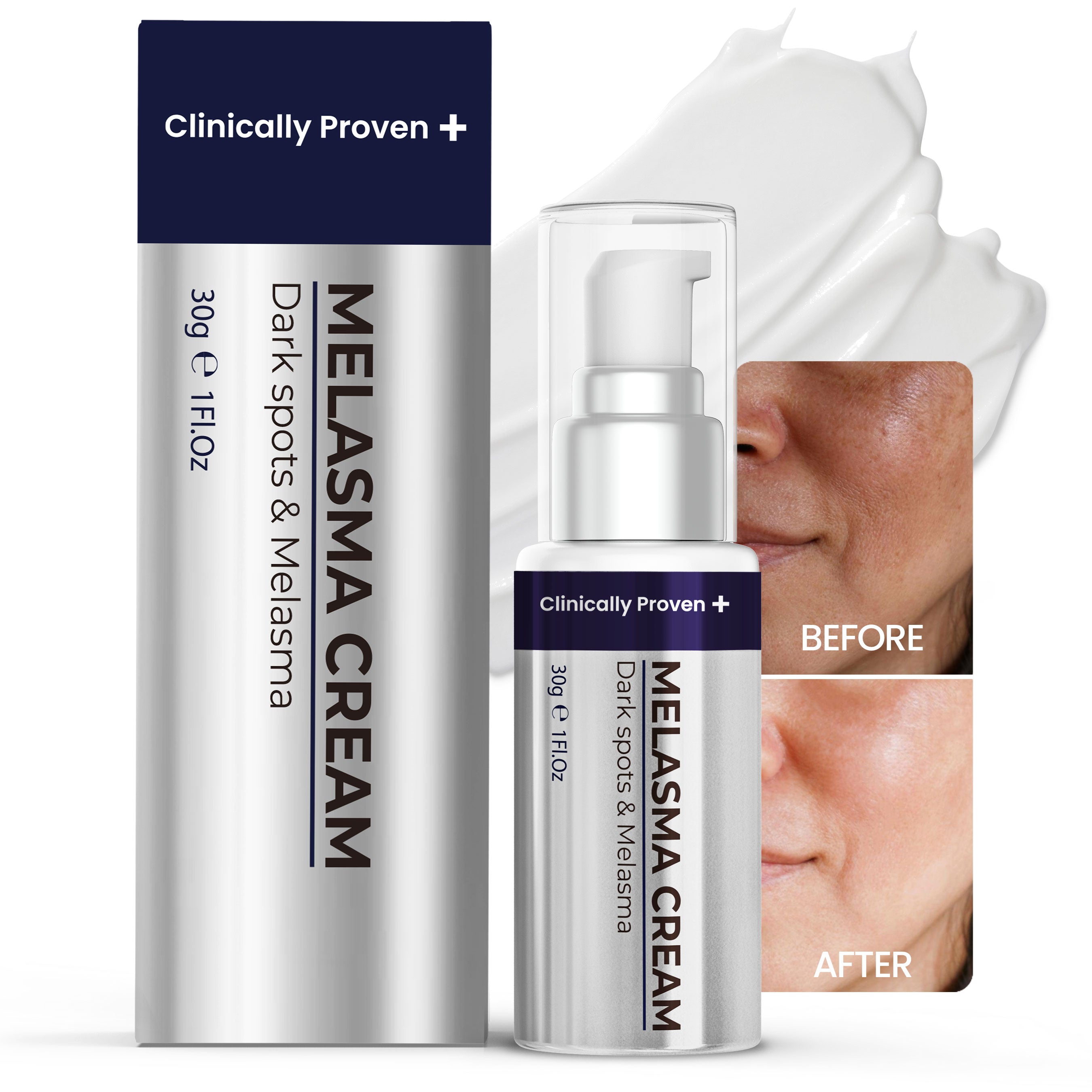 Melasma Treatment for Face &amp; Body Cream: Reduces Dark Spots, Age Spots and Promotes Even-Toned Skin with Vitamin C