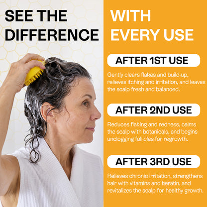 Psoriasis Shampoo for Dry, Itchy &amp; Flaky Scalp | Eczema, Folliculitis &amp; Seborrheic Dermatitis Care | Manuka Honey – 200ml