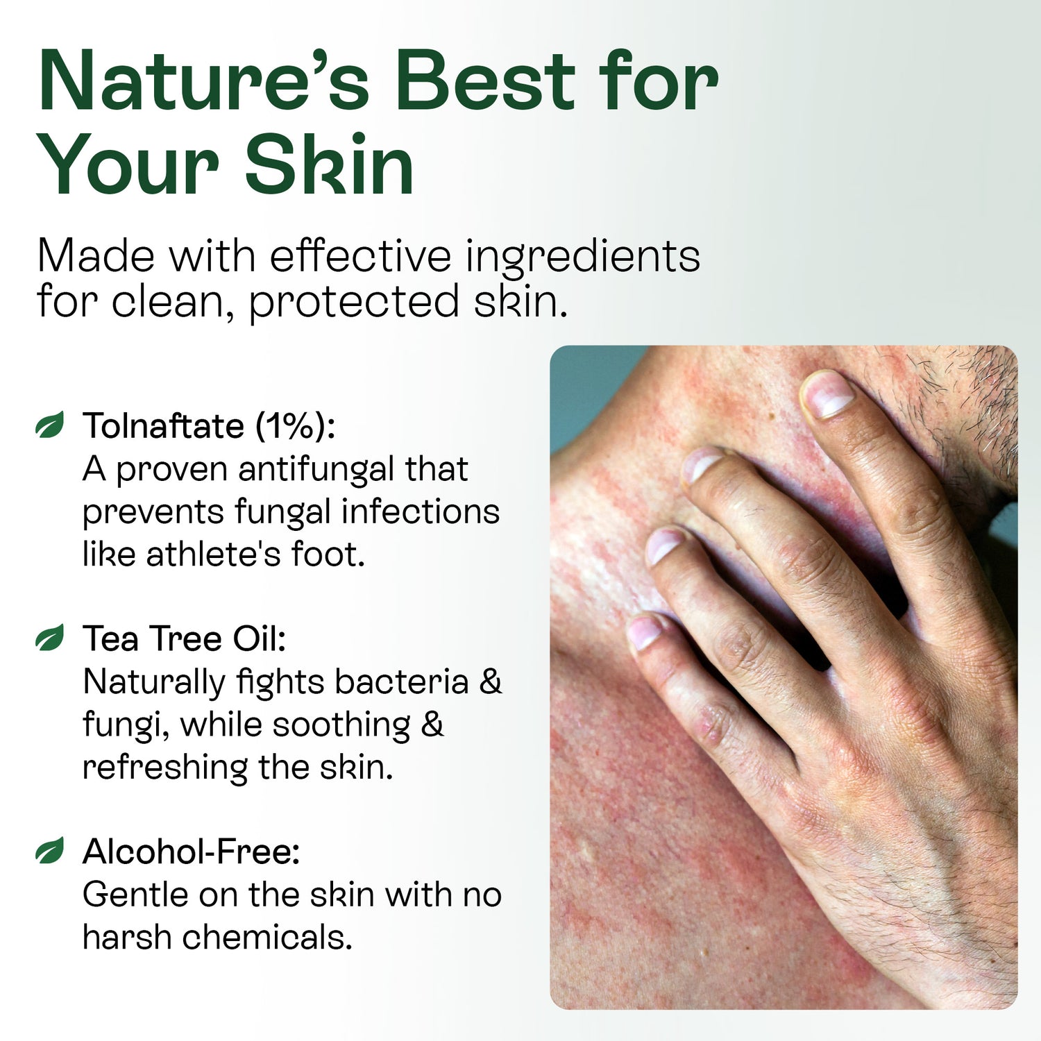 Medicated Antifungal Body Wipes for Ringworm, Jock Itch &amp; Athlete’s Foot