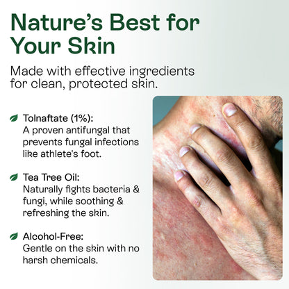 Medicated Antifungal Body Wipes for Ringworm, Jock Itch &amp; Athlete’s Foot