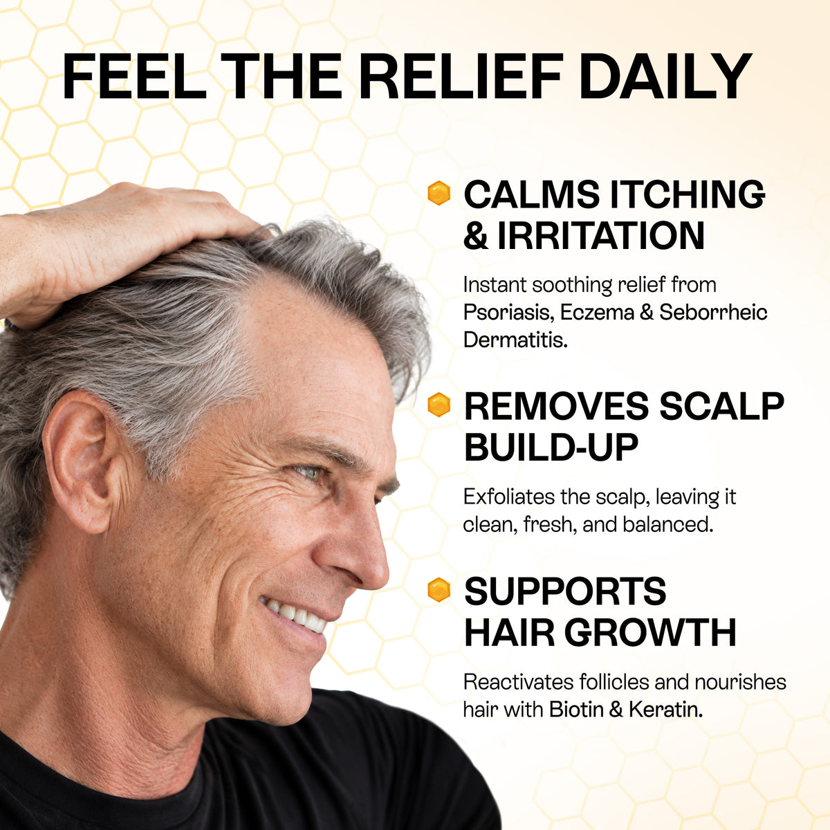 Psoriasis Shampoo for Dry, Itchy &amp; Flaky Scalp | Eczema, Folliculitis &amp; Seborrheic Dermatitis Care | Manuka Honey – 200ml