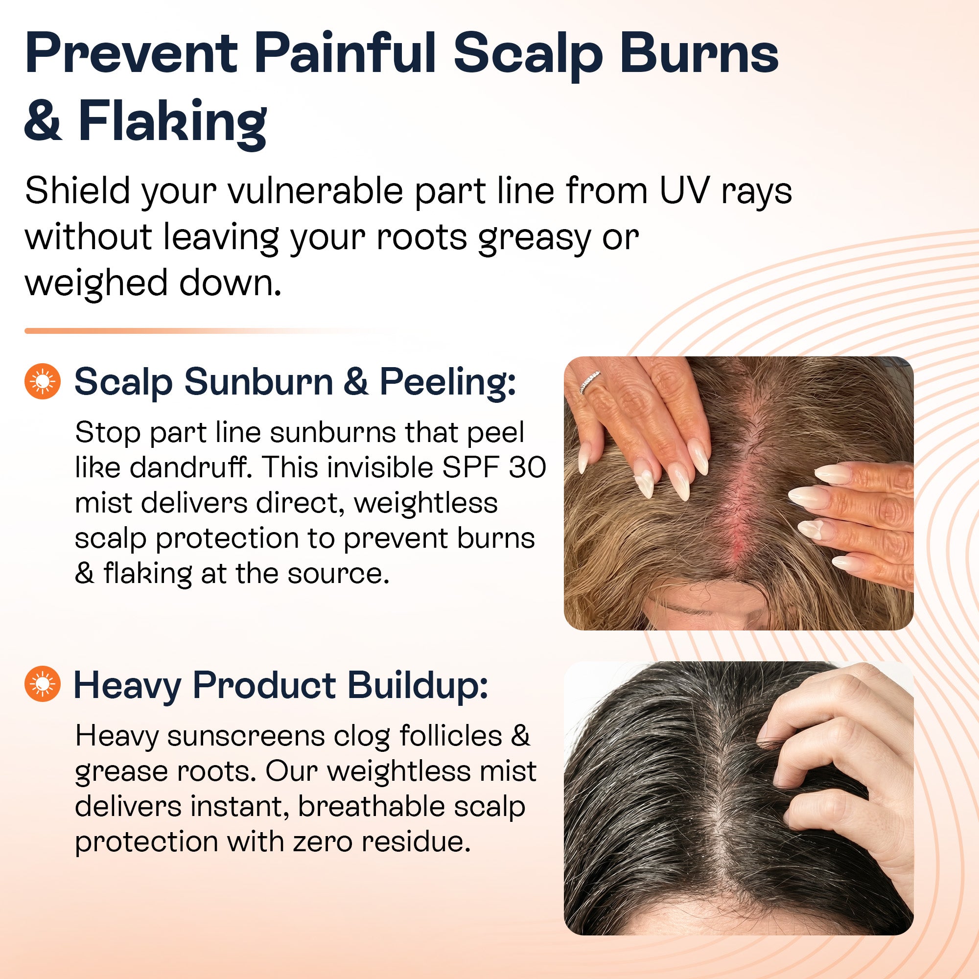 Scalp Sunscreen Spray SPF 30 | UV &amp; Heat Protection for Hair &amp; Scalp
