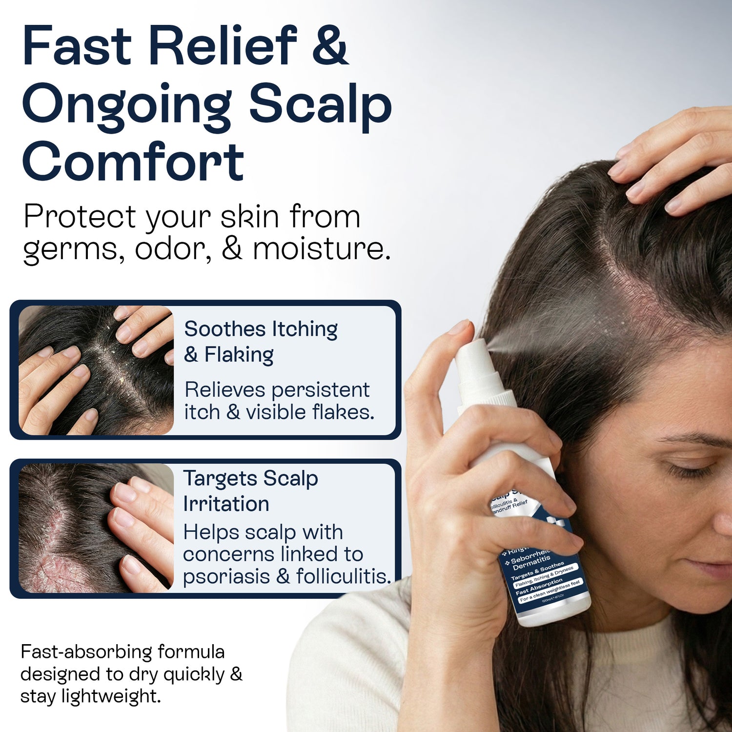 Psoriasis Scalp Spray for Flaking, Itching &amp; Dryness
