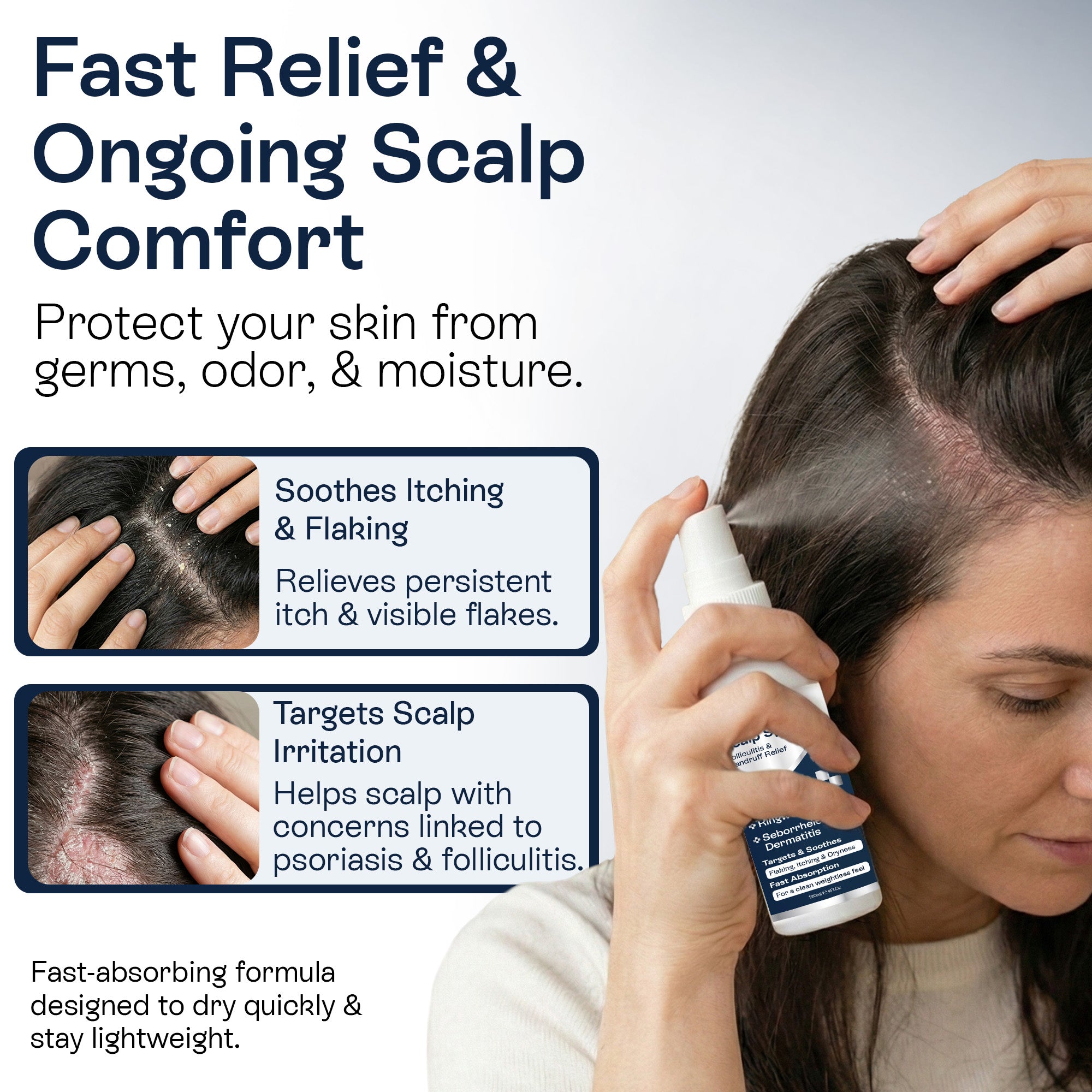 Psoriasis Scalp Spray for Flaking, Itching &amp; Dryness