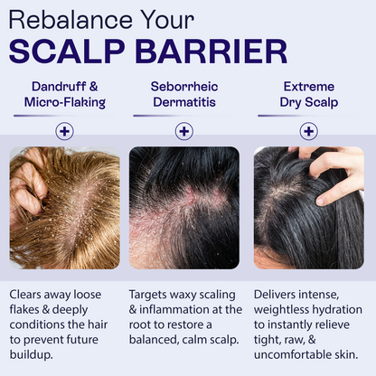 Keto Conditioner | Anti-Dandruff &amp; Scalp Relief Care