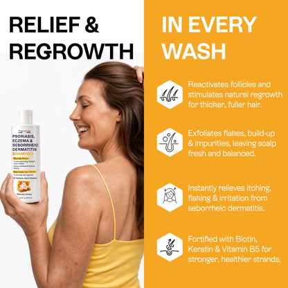 Psoriasis Shampoo for Dry, Itchy &amp; Flaky Scalp | Eczema, Folliculitis &amp; Seborrheic Dermatitis Care | Manuka Honey – 200ml