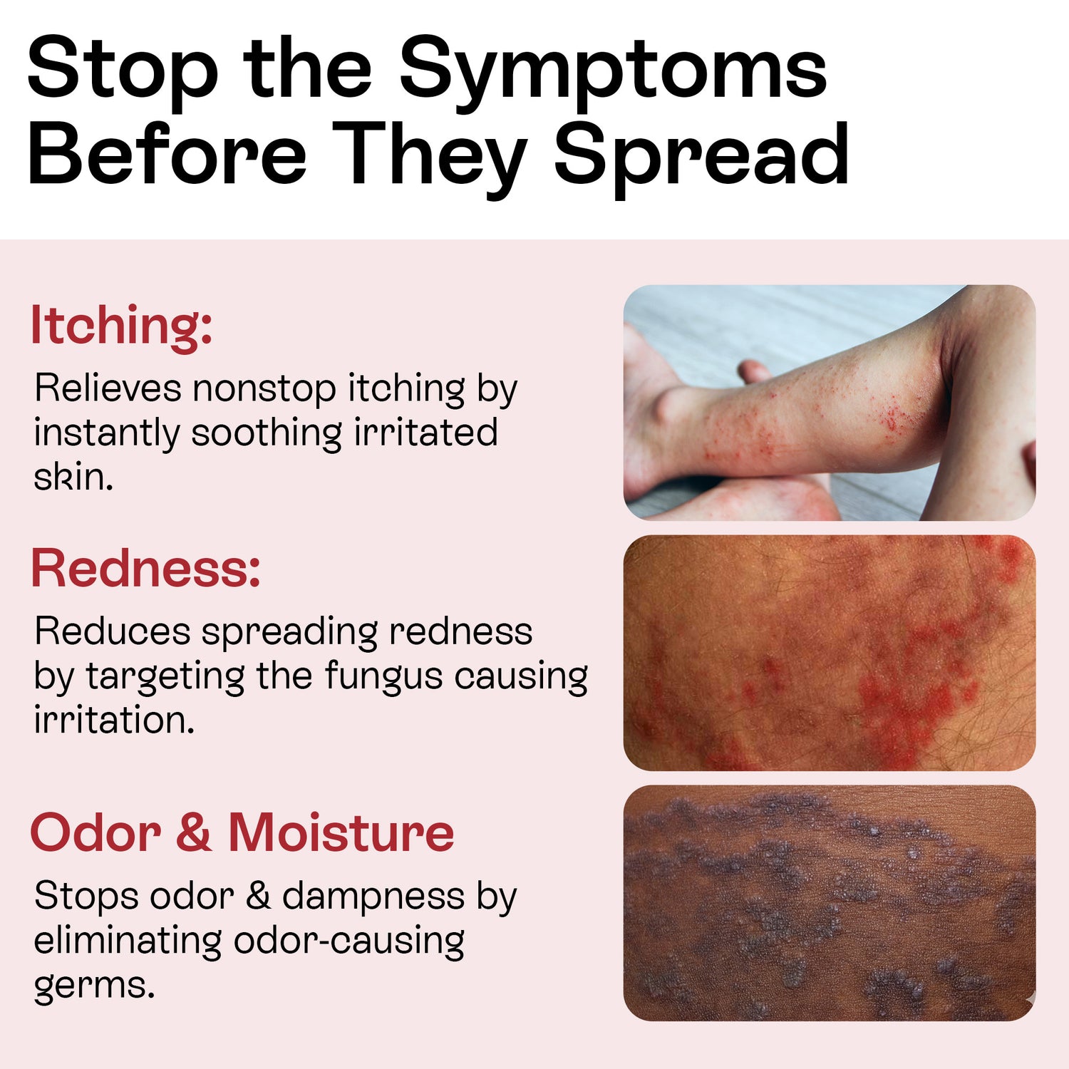 Jock Itch Antifungal Cream for Itching, Redness &amp; Odor Relief