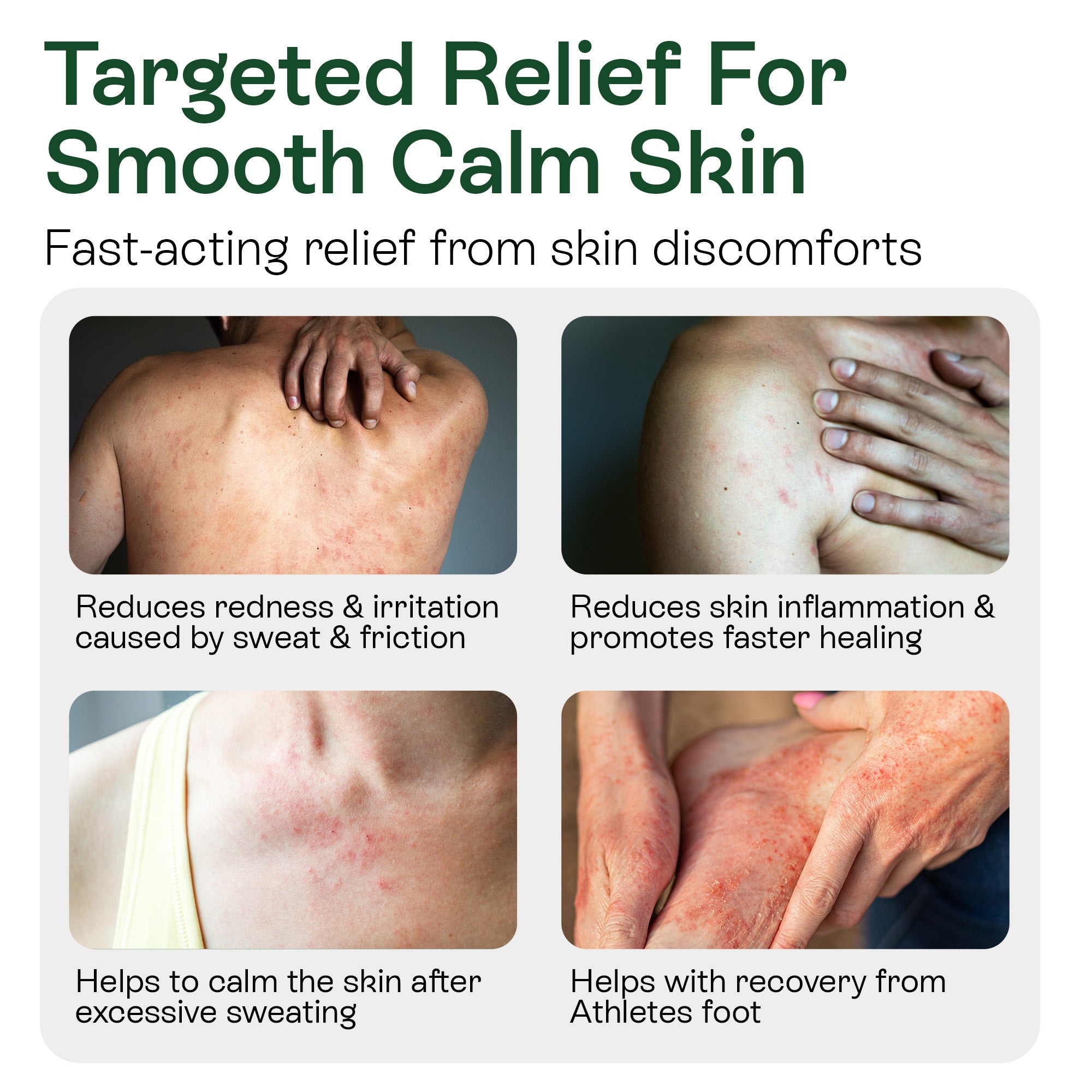 Medicated Antifungal Body Wipes for Ringworm, Jock Itch &amp; Athlete’s Foot