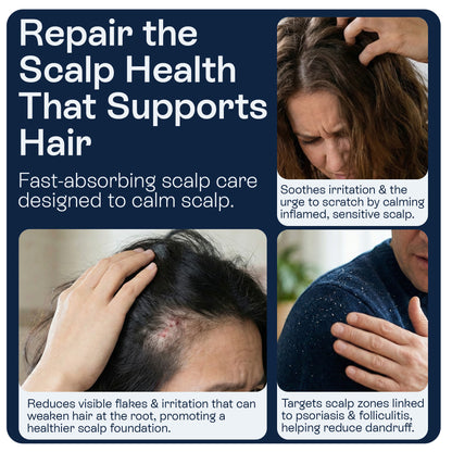 Psoriasis Scalp Spray for Flaking, Itching &amp; Dryness