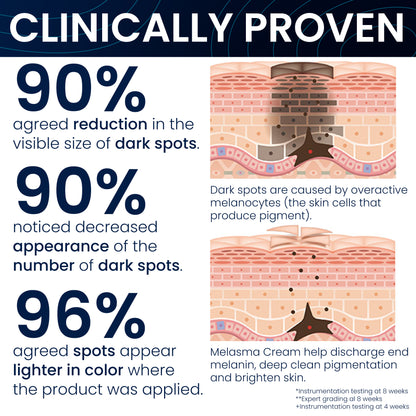 Melasma Treatment for Face &amp; Body Cream: Reduces Dark Spots, Age Spots and Promotes Even-Toned Skin with Vitamin C