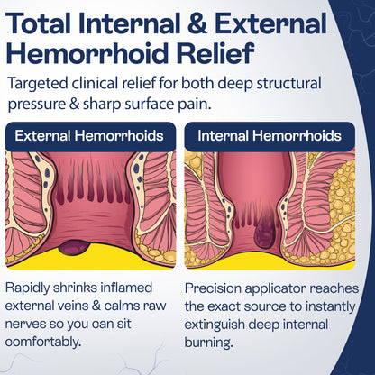 Hemorrhoid Cream | Fast Relief for Pain, Itching &amp; Discomfort