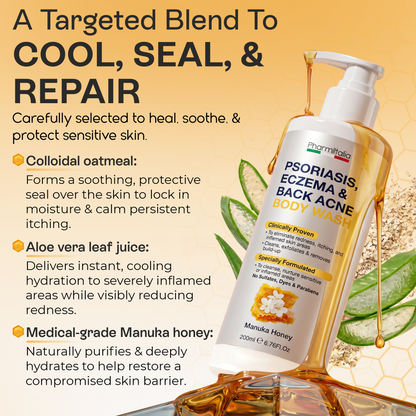 Psoriasis Body Wash | Itch, Redness &amp; Flake Relief