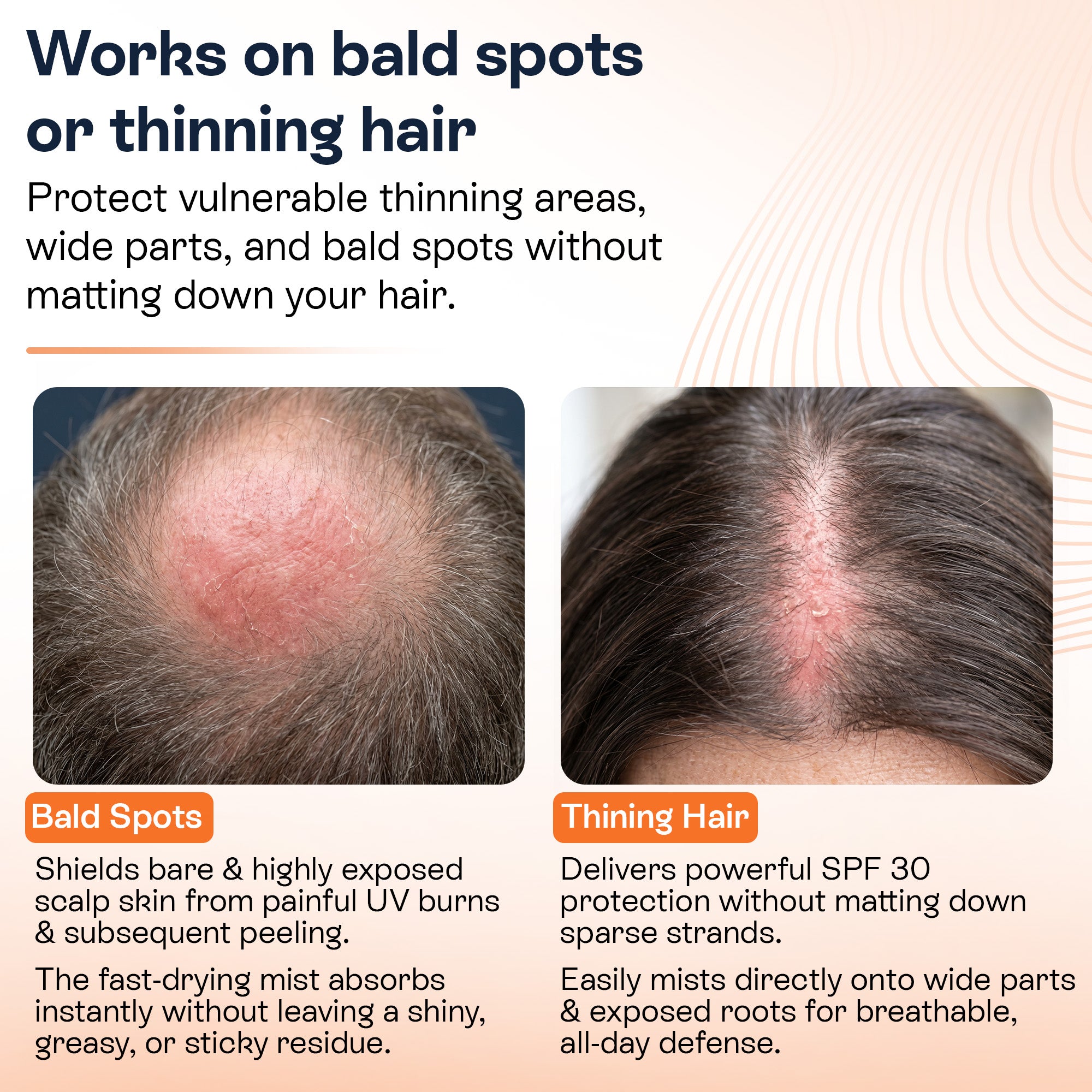Scalp Sunscreen Spray SPF 30 | UV &amp; Heat Protection for Hair &amp; Scalp