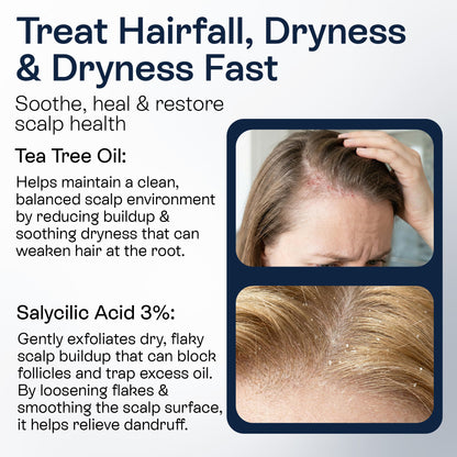 Psoriasis Scalp Spray for Flaking, Itching &amp; Dryness