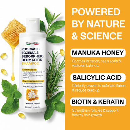 Psoriasis Shampoo for Dry, Itchy &amp; Flaky Scalp | Eczema, Folliculitis &amp; Seborrheic Dermatitis Care | Manuka Honey – 200ml