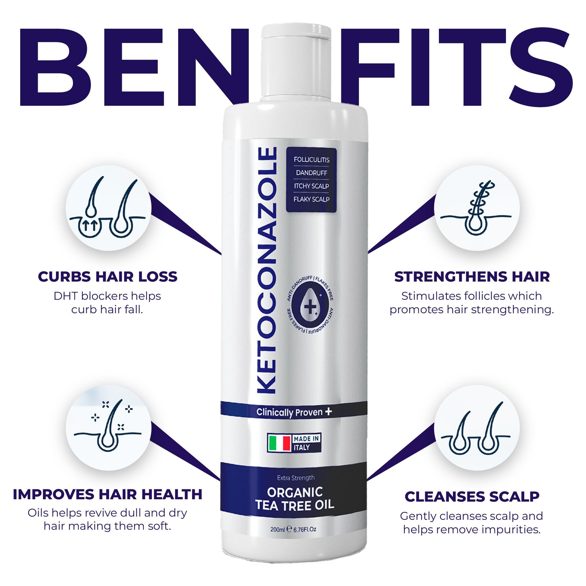 Psoriasis 1% Ketoconazole Anti Dandruff Shampoo