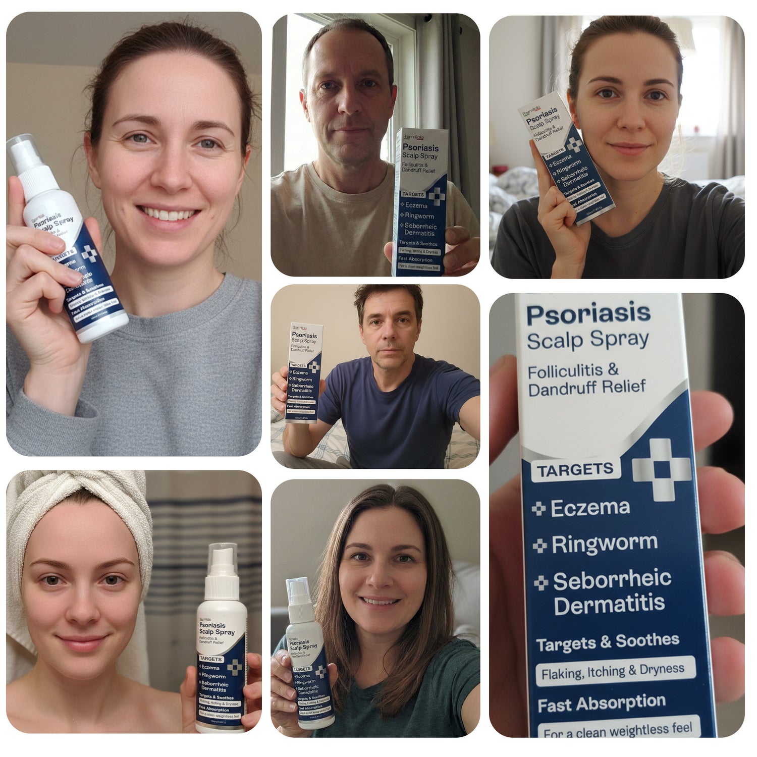 Psoriasis Scalp Spray for Flaking, Itching &amp; Dryness