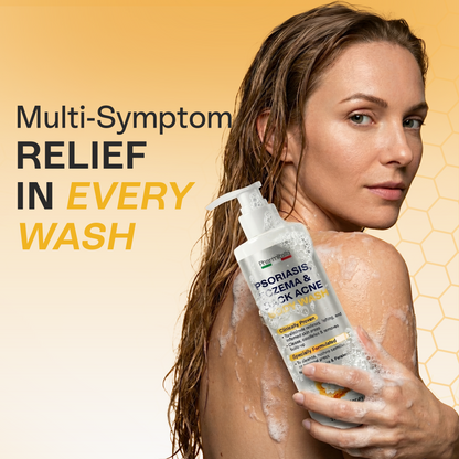 Psoriasis Body Wash | Itch, Redness &amp; Flake Relief