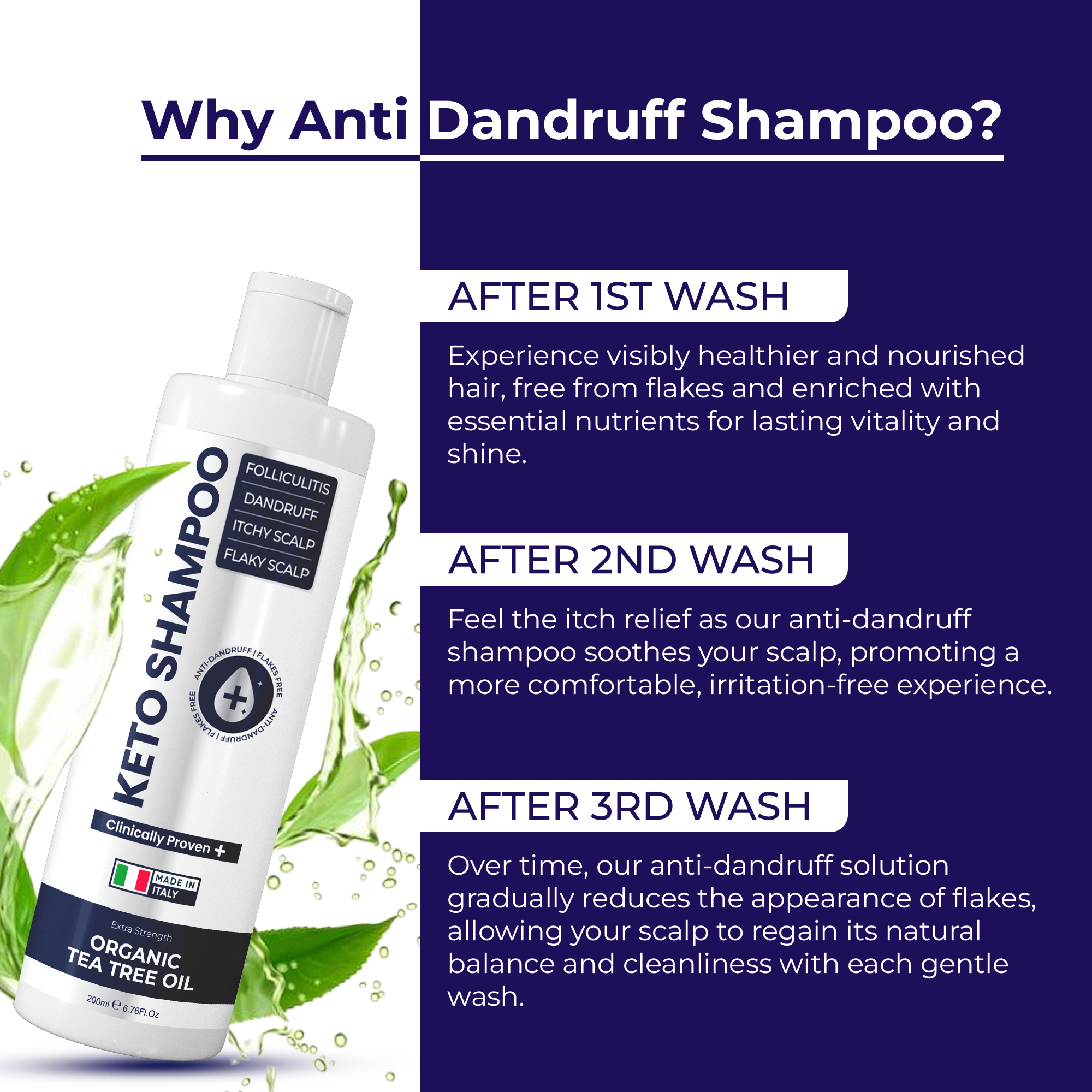 Keto Shampoo for Dandruff, Psoriasis, Folliculitis &amp; Seborrheic Dermatitis | Anti-Fungal Itchy Scalp Relief