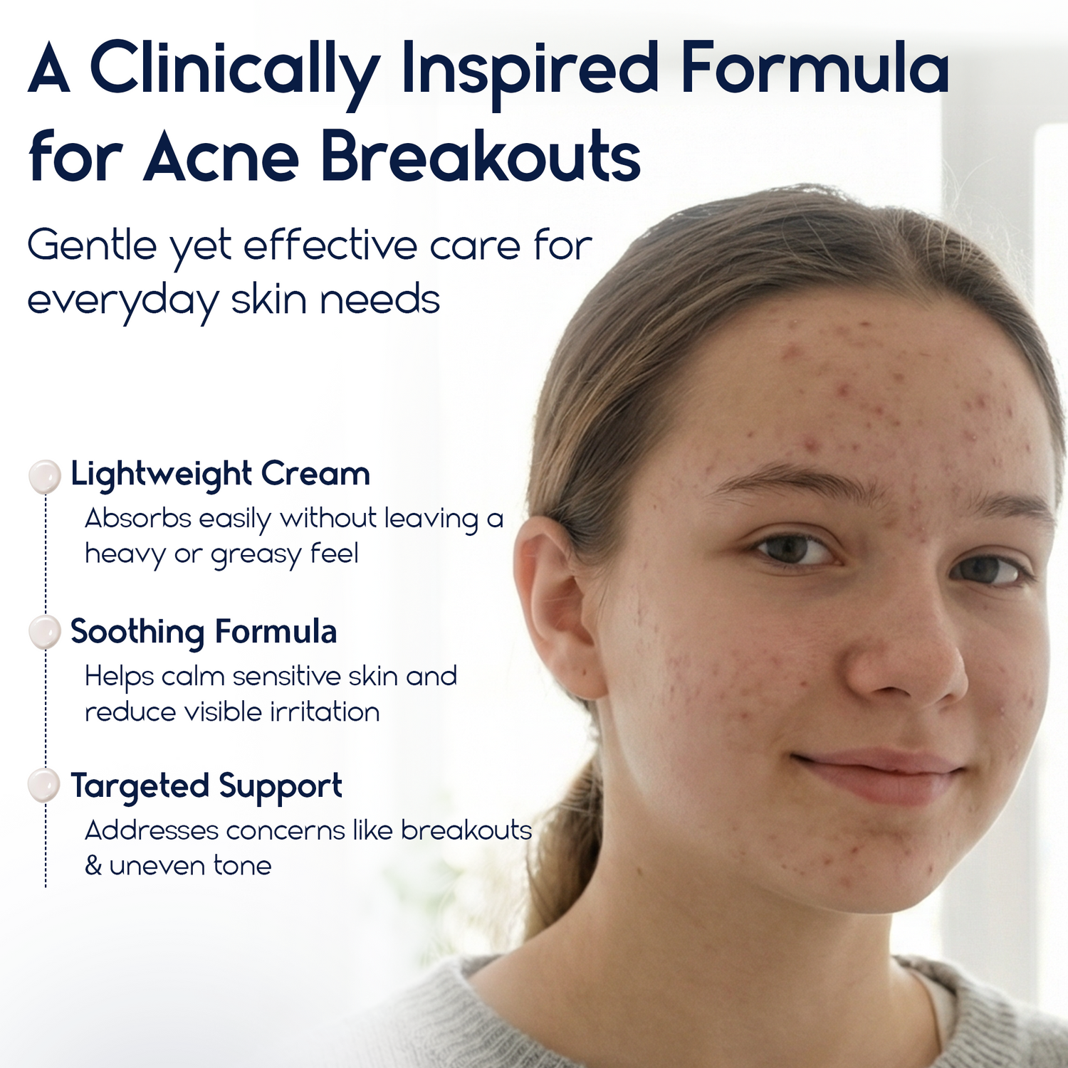 Azelaic Acid 15% Cream – Acne Control, Redness Relief &amp; Tone Correction | 30ml