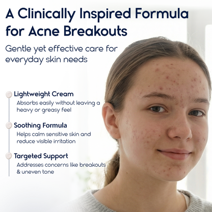 Azelaic Acid 15% Cream – Acne Control, Redness Relief &amp; Tone Correction | 30ml