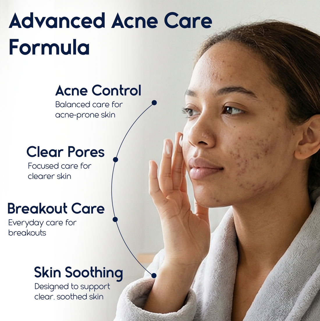 Azelaic Acid 15% Cream – Acne Control, Redness Relief &amp; Tone Correction | 30ml