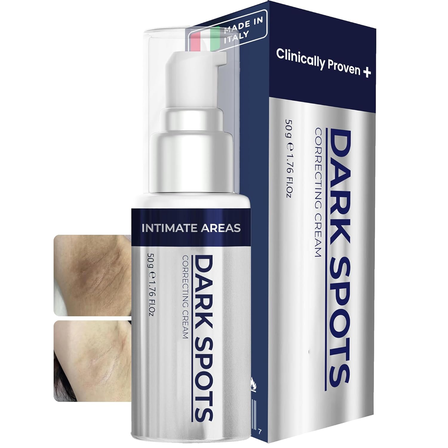 Dark Spot Corrector - Extra Strength Skin Bleaching Cream