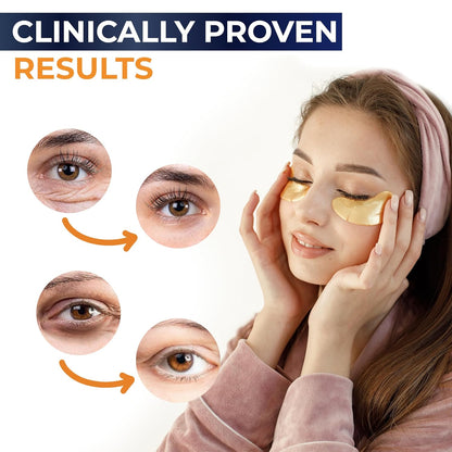 Anti-aging under-eye patches with Collagen &amp; Hyaluronic Acid reduce puffiness, dark circles, and wrinkles—wake up refreshed with younger-looking eyes!