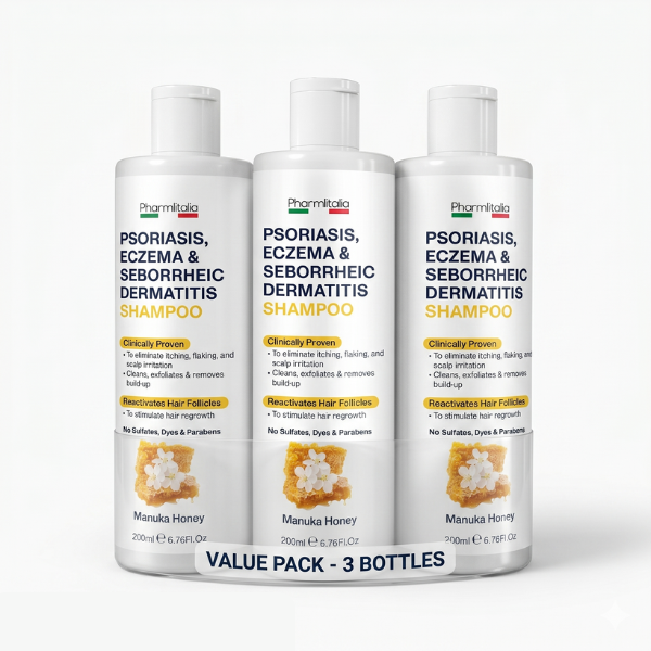 Psoriasis Shampoo for Dry, Itchy &amp; Flaky Scalp | Eczema, Folliculitis &amp; Seborrheic Dermatitis Care | Manuka Honey – 200ml