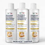 3 Bottles