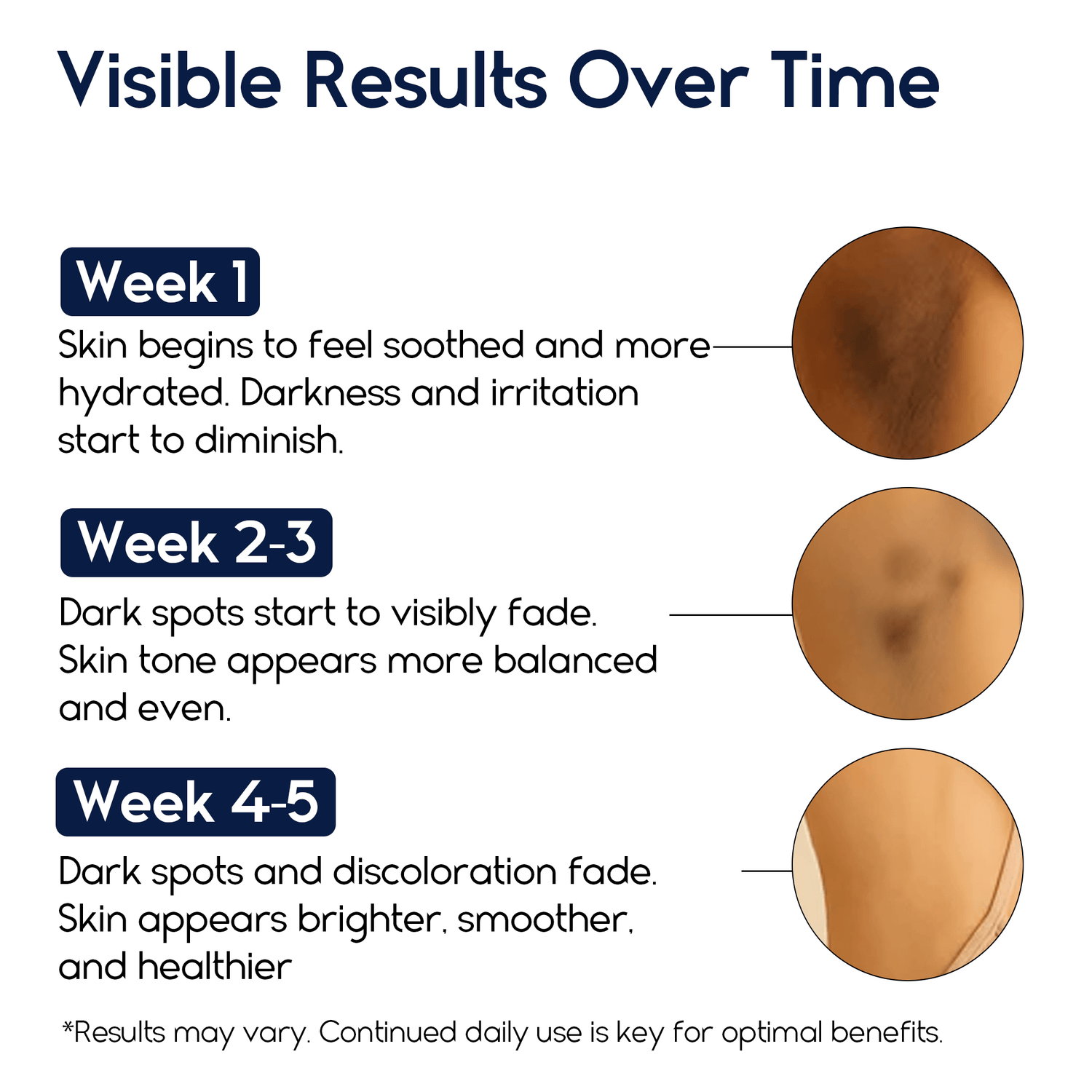 Dark Spot Corrector - Pharmlitalia