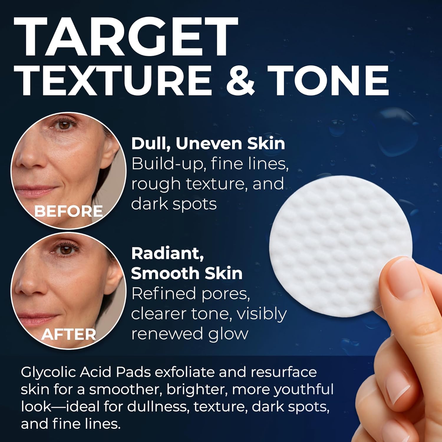 Glycolic Acid Pads For Dark Spots - Pharmlitalia