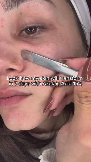 Feeling confident without makeup