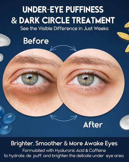 Retinol Eye Cream - Pharmlitalia