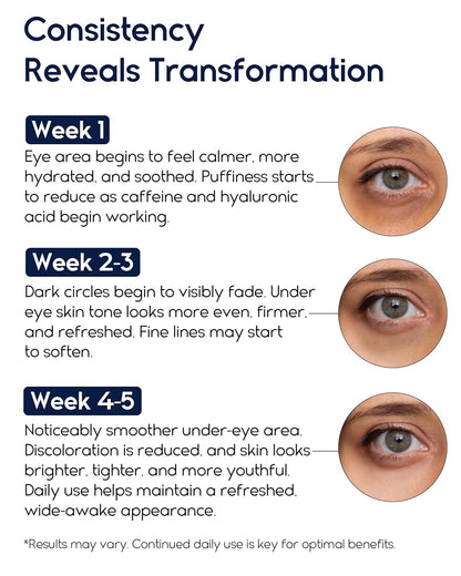 Retinol Eye Cream - Pharmlitalia